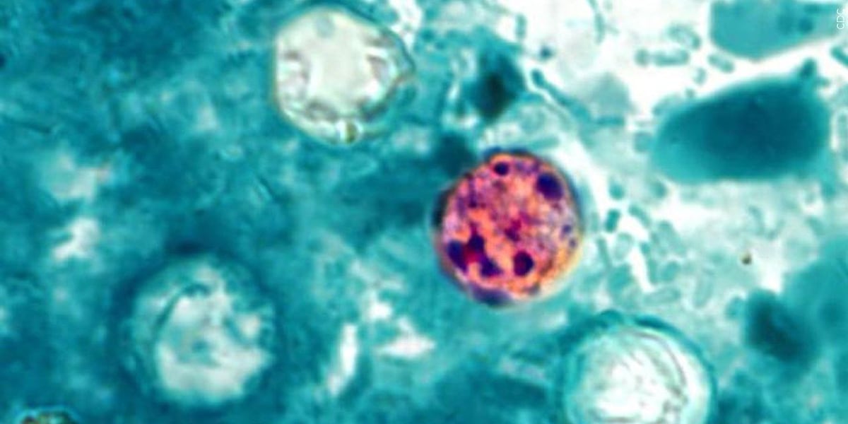Cyclosporiasis outbreak linked to iceberg lettuce reaches Maine - WABI