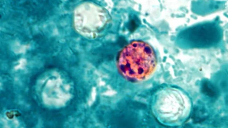 Cyclosporiasis