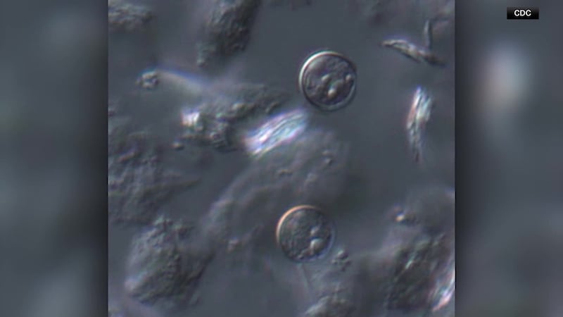 A cyclosporiasis outbreak linked to shredded iceberg lettuce has expanded to 15 states, with...
